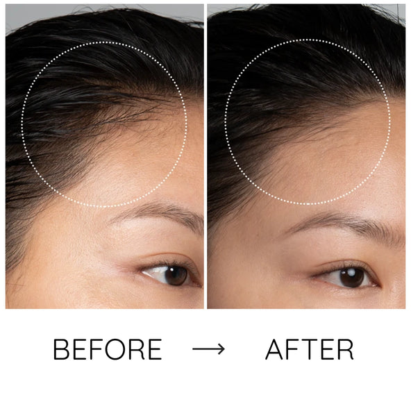 Der sanfte Boost, den Ihr Haar verdient: gesünder, glänzender und voller.