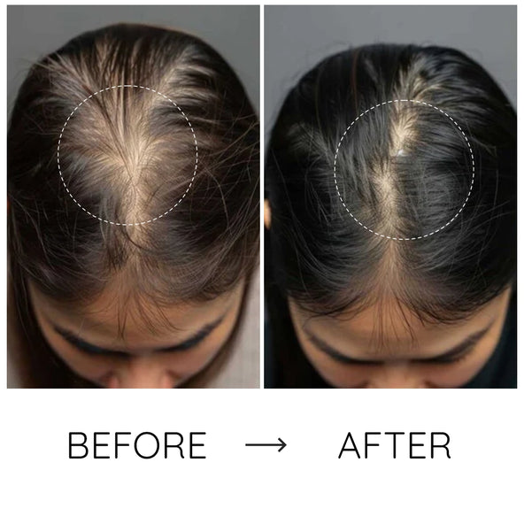 Der sanfte Boost, den Ihr Haar verdient: gesünder, glänzender und voller.